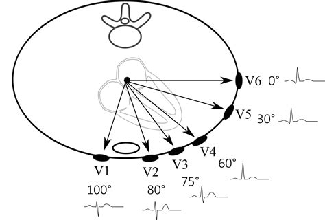 Electrocardiogram Guide (EKG/ECG) - Stepwards