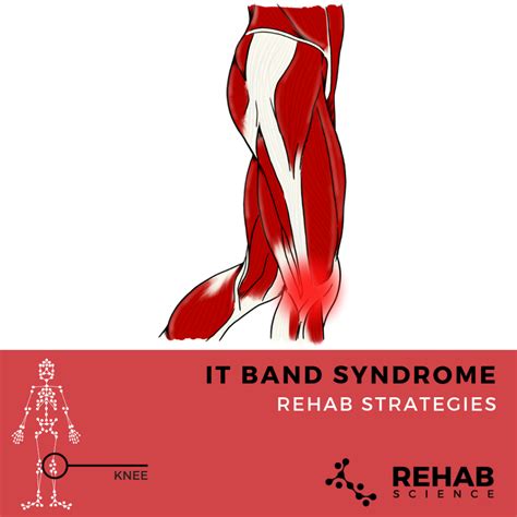 IT Band Syndrome - Rehab Science