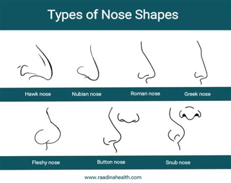 Different Nose Types