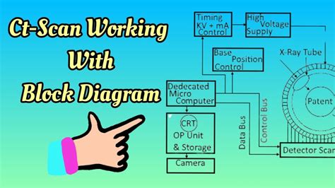 Ct Scan Block Diagram - Captions Hunter