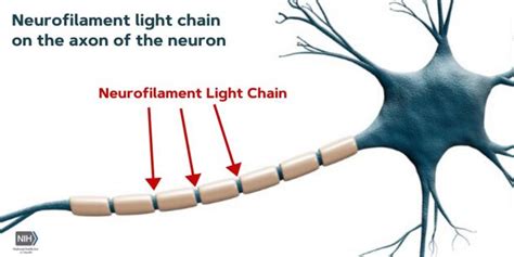 Neurofilament Light Chain on t [IMAGE] | EurekAlert! Science News Releases