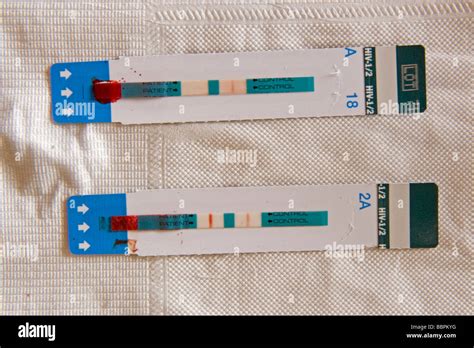 Hiv Test Results