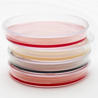 Types of Agar Plates | Sciencing