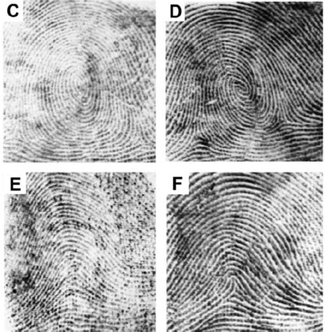 Ulnar Loop Fingerprint