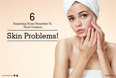 6 Surprising Home Remedies To Treat Common Skin Problems! - By Dr ...