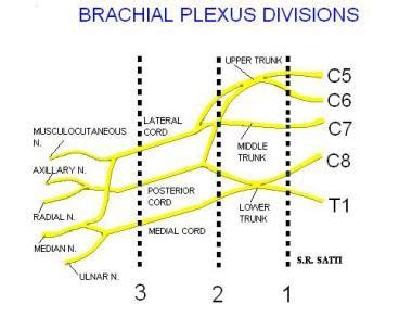 Brachial Plexus Injury Mri