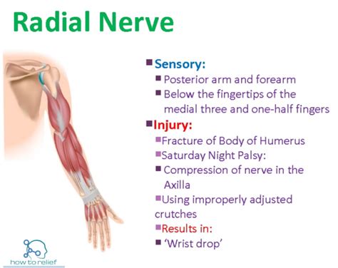 Radial Nerve : Course, Motor, Sensory & Common Injuries » How To Relief