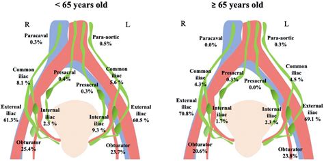 Sentinel Pelvic Lymph Nodes