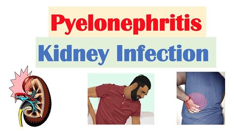 Pyelonephritis