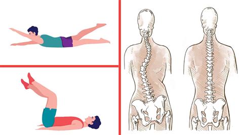 6 Stretches That Can Help Heal Scoliosis | 6 Minute Read