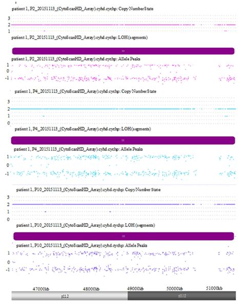 Example of cn-LOH detection using SNP array analysis. Three different... | Download Scientific ...