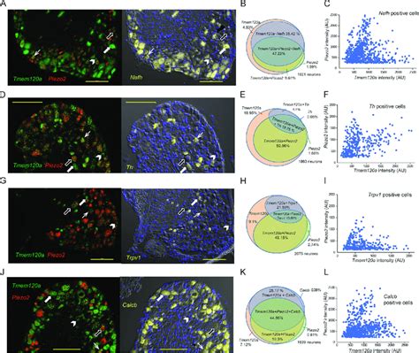 Tmem120a and Piezo2 are coexpressed in various DRG populations.... | Download Scientific Diagram