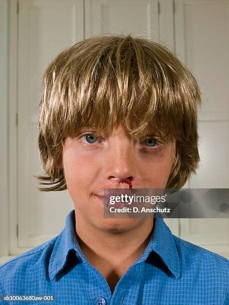 Child Bloody Nose Photos and Premium High Res Pictures - Getty Images