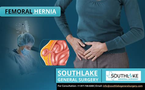 Femoral Hernia Surgery at Southlake General Surgery - Southlake General Surgery