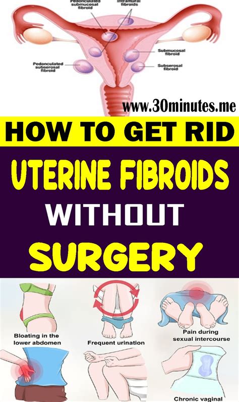 Large Fibroid Uterus Surgery