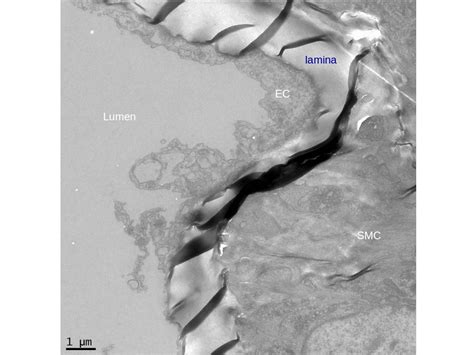 What could be preventing the basal lamina from being preserved in mouse aortic ring electron ...