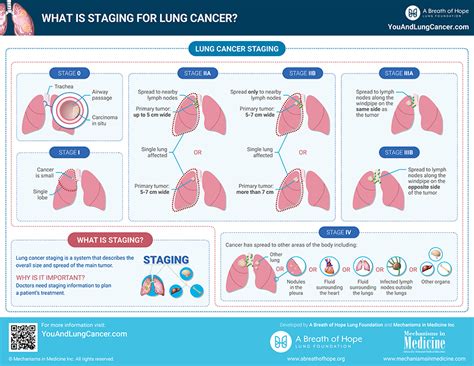 Infographics