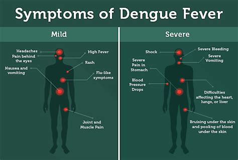 Blog for Dengue Symptons and prevention- Flores Hospital