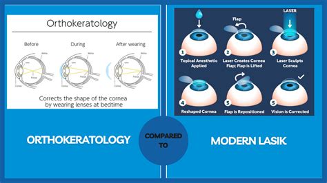 Orthokeratology and LASIK: A Comparison | LASIK.com™ Official Site