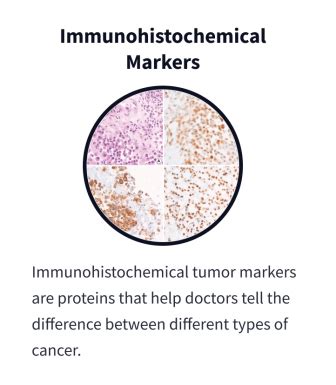 Immunohistochemical Tumor Markers | Proteins That Help Diagnose Mesothelioma