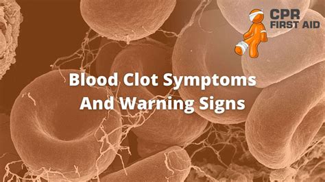 Blood Clot Symptoms And Warning Signs | CPR First Aid