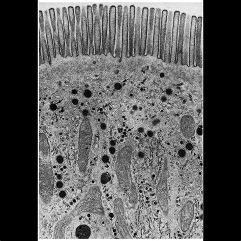 CIL:10790, Rattus, brush border epithelial cell. CIL. Dataset