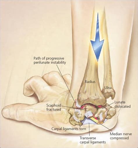 The Orthopedic Edge: Kobe Pushing His Wrist Injury Too Far?