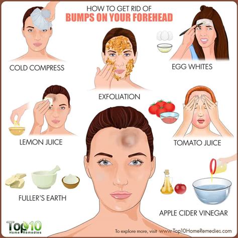 How to Get Rid of Bumps on Forehead | Top 10 Home Remedies