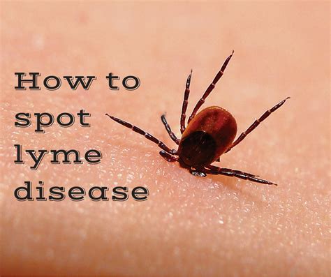 ActivMed Clinical Trials MA NH: Beware the Tick Bite: Prevention and Early Signs you may have ...