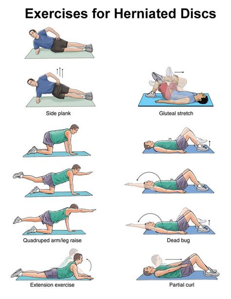 Herniated Disc Exercises