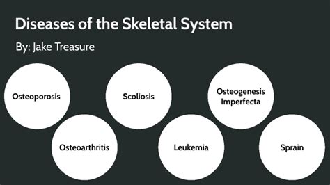 Diseases of the Skeletal System by Jake Treasure on Prezi