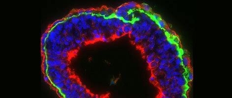 Highly validated Alexa Fluor conjugated secondary antibodies