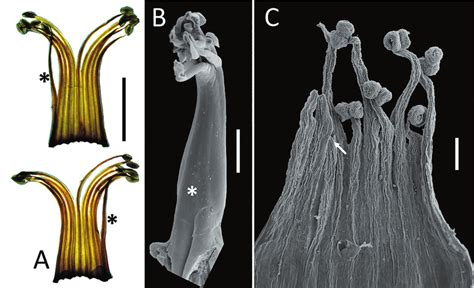 Morphology of androecium. A -Tipuana tipu, monadelphous androecium... | Download Scientific Diagram