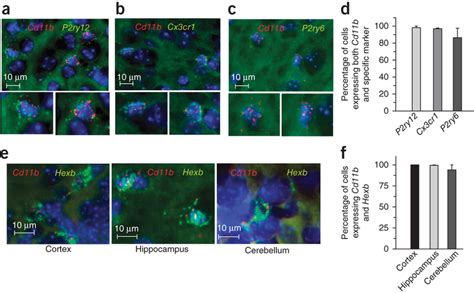 RNAscope dual fluorescence in situ hybridization. Dual RNAscope was...