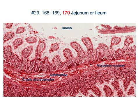 PPT - GI Sequence - Histology PowerPoint Presentation, free download ...