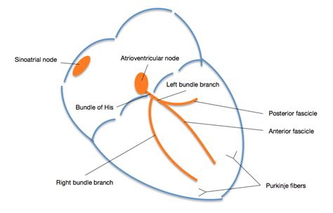 Bundle Branch Blocks: 101 - REBEL EM - Emergency Medicine Blog