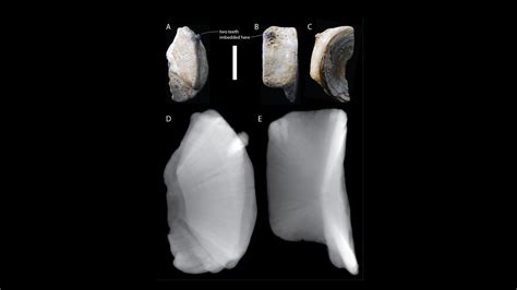 'Truly remarkable' fossil is rare evidence of ancient shark-on-shark attacks | Live Science