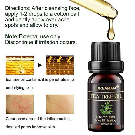 Tea Tree Oil,Acne Treatment,Tea Tree Acne Oil,Acne Oil Serum,Get Rid of ...