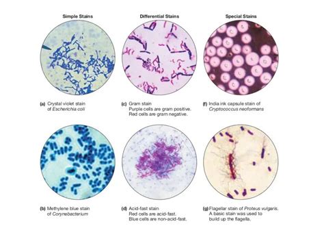 Types of Staining Techniques Used in Microbiology • Microbe Online