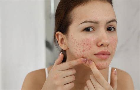 Skin Inflammation: Causes, Symptoms, Diagnosis, And Treatment