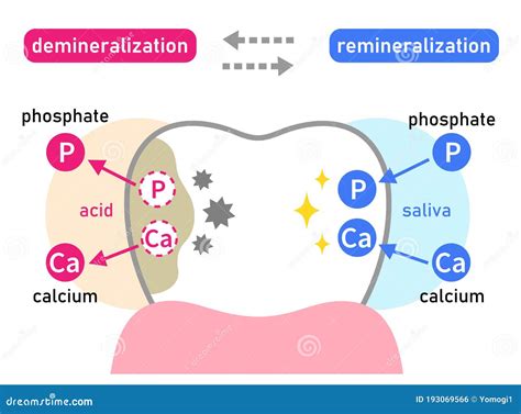 Diagrama De Desmineralização E Remineralização Dos Dentes. Conceito De Cuidados Dentários ...