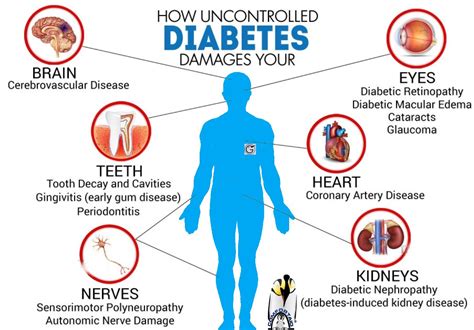 Kidney Disease Complications Of Diabetes - DiabetesWalls