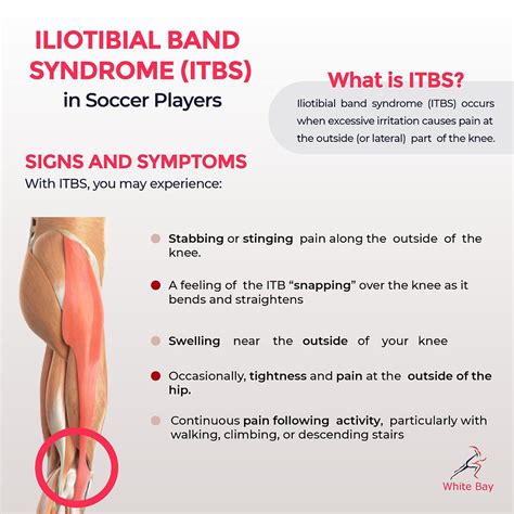 Illiotibial Band Syndrome (ITBS) in Soccer Players