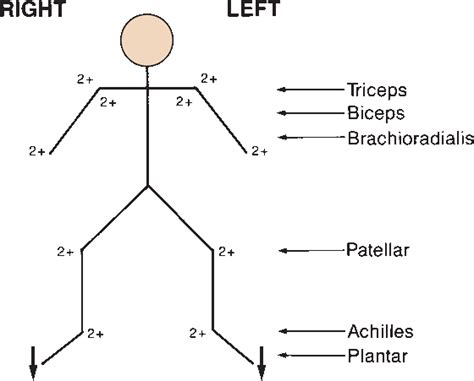 Deep Tendon Reflex Scale