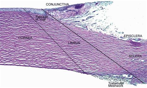 Cornea and Sclera | Ento Key