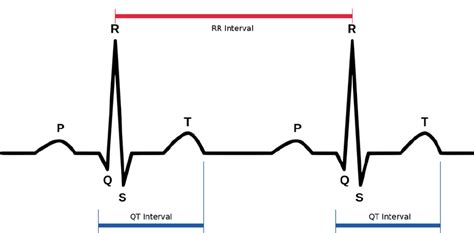 Normal Ecg Tracing