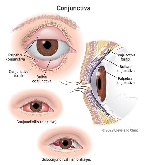 Conjunctiva: Anatomy, Function & Common Conditions