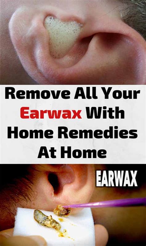 Ear Wax Removal Ingredients