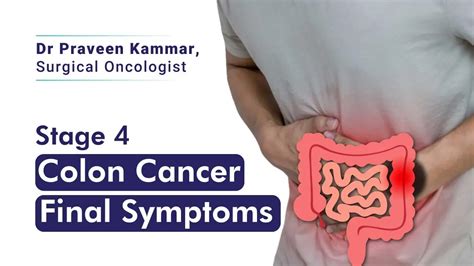 How to Spot the Last Symptoms of Colon Cancer | Dr. Praveen Kammar