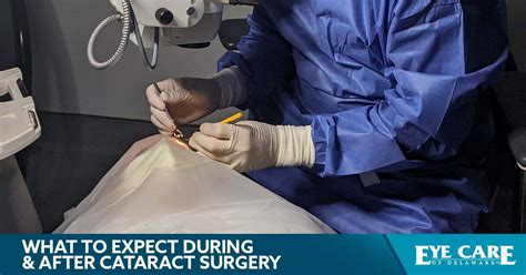 What to Expect During & After Cataract Surgery – Eye Care of Delaware